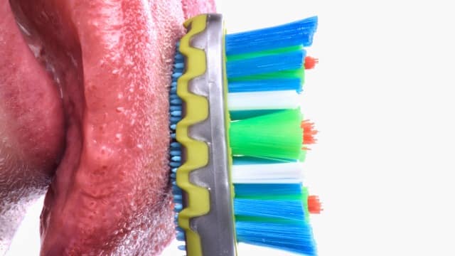 Lengua saburrial primer plano