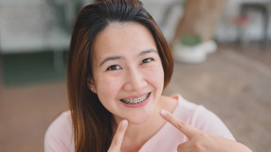 วิธีทำให้ฟันขาวสําหรับคนจัดฟัน