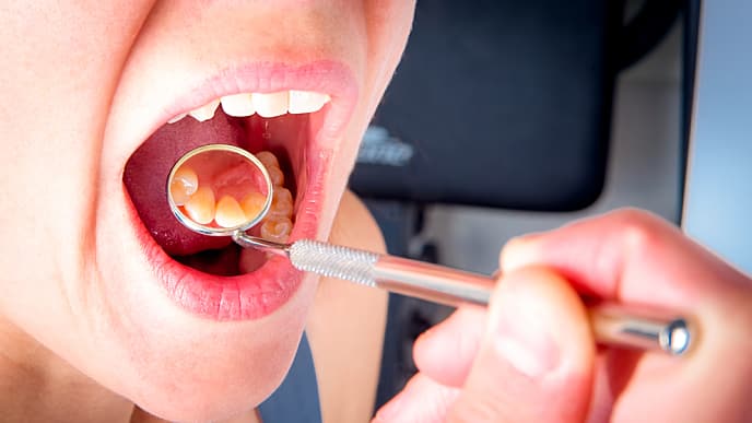 niño en el dentista