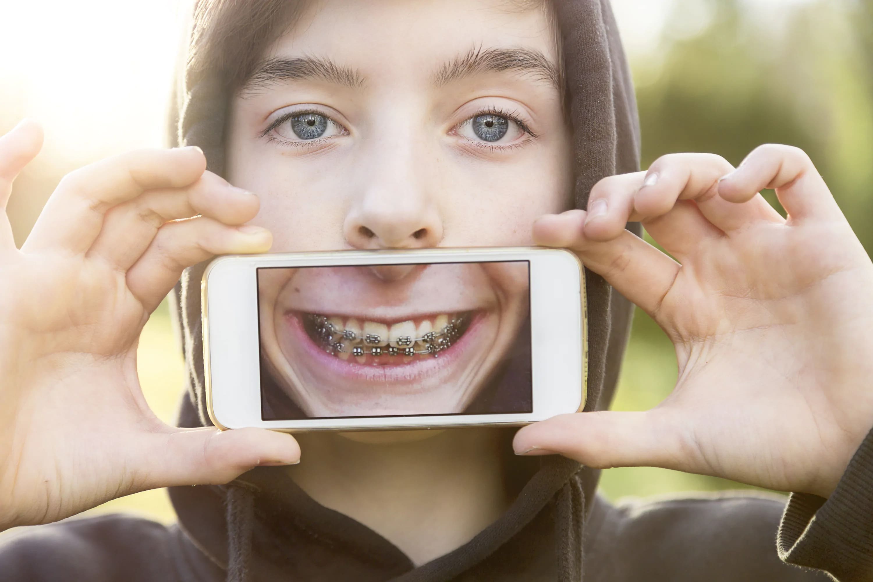 Cost of Braces in Canada: What You Need To Know