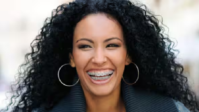 Mujer con ortodoncia sonriendo