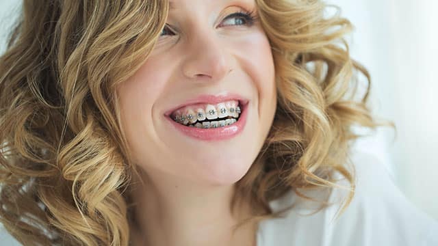 How Much Are Braces With Insurance?